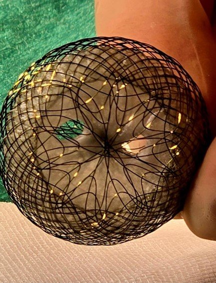 U novembru planirane tri interventne procedure sa koarktacijom aorte kod djece