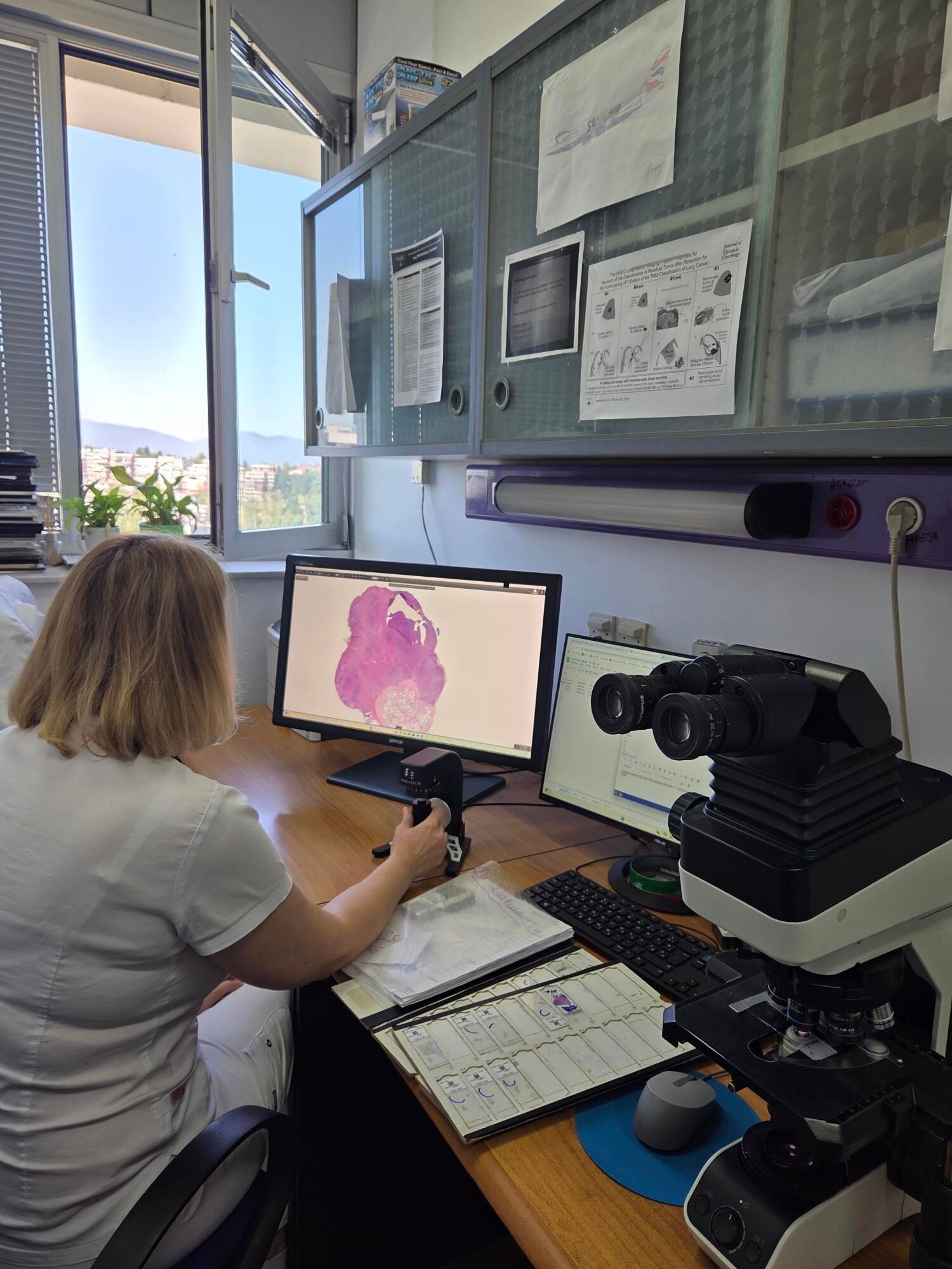 KCUS završava digitalizaciju OJ Kliničke patologije, citologije i humane genetike