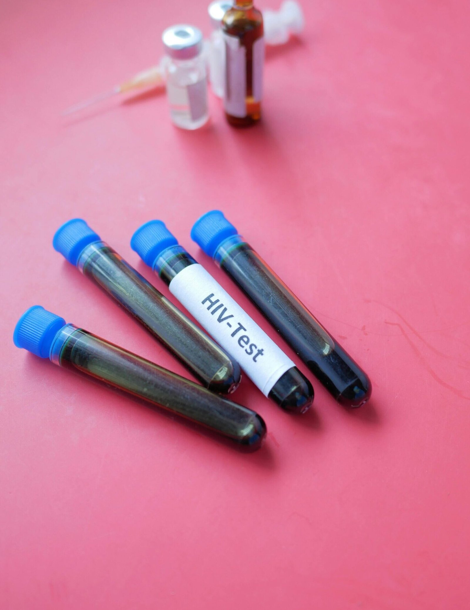 KCUS I OVE GODINE UČESTVUJE U OBILJEŽAVANJU SVJETSKOG DANA BORBE PROTIV HIV/AIDS-a